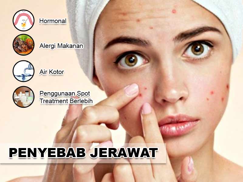 Berapa Harga Verile Acne Facial Wash